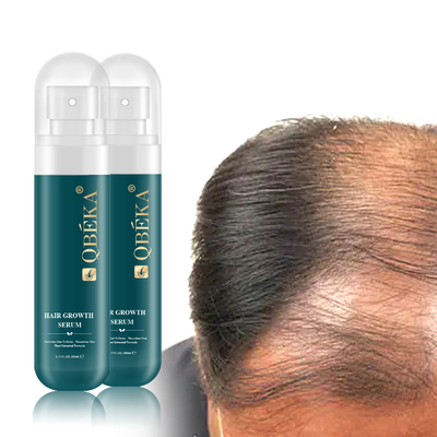 80 ml de soro herbal anti perda de cabelo para prevenir a perda de cabelo
