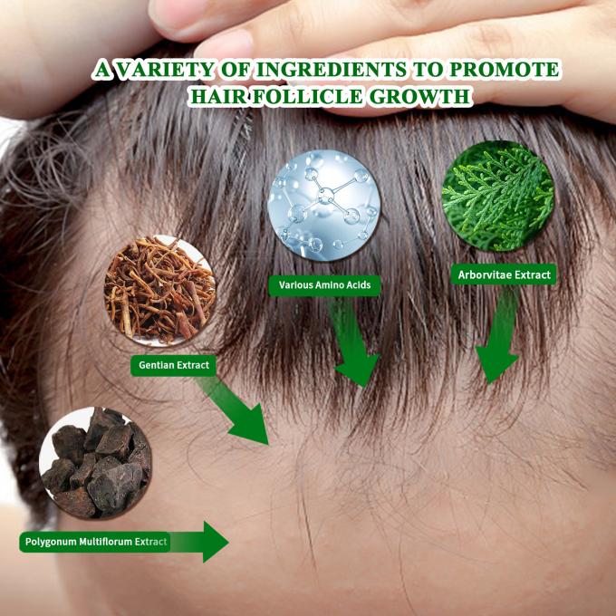 Sérum orgânico de crescimento do cabelo Uso externo Tratamento de crescimento do cabelo Anti-perda de cabelo Spray 80ml 0