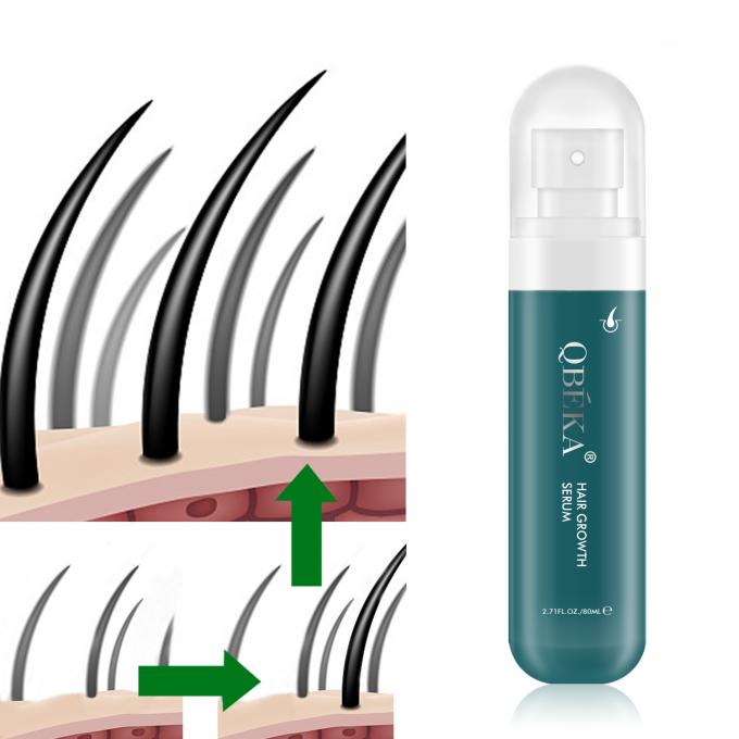 80 ml Óleo de Crescimento do Cabelo Produto de Marca Privada Equipa Profissional de QC Sério Anti-Perda de Cabelo 0