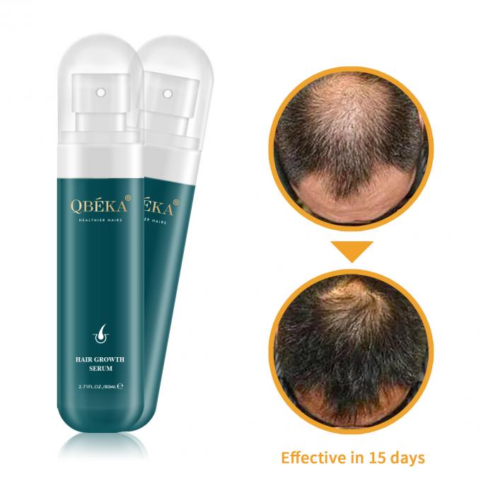 80 ml Óleo de Crescimento do Cabelo Produto de Marca Privada Equipa Profissional de QC Sério Anti-Perda de Cabelo 1