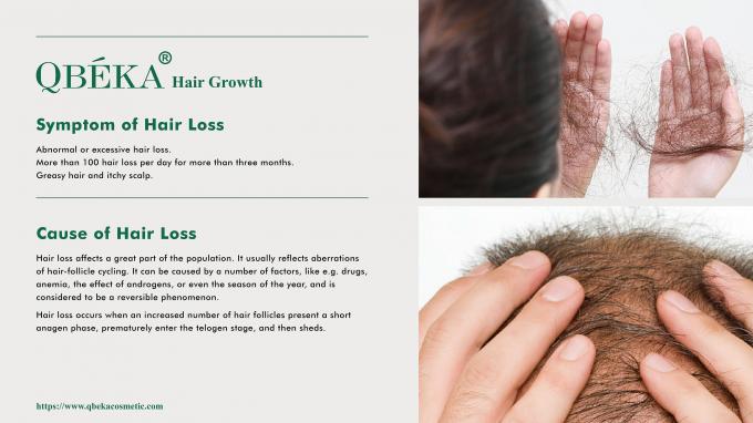 GMPC Standard 80ml Serum O Último Remédio Para Alopecia Areata Tratamento Perto de Mim 0
