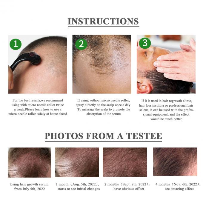 Serum de crescimento do cabelo de ervas 7-15 dias Restaurar o volume e brilho do seu cabelo sem esforço 3
