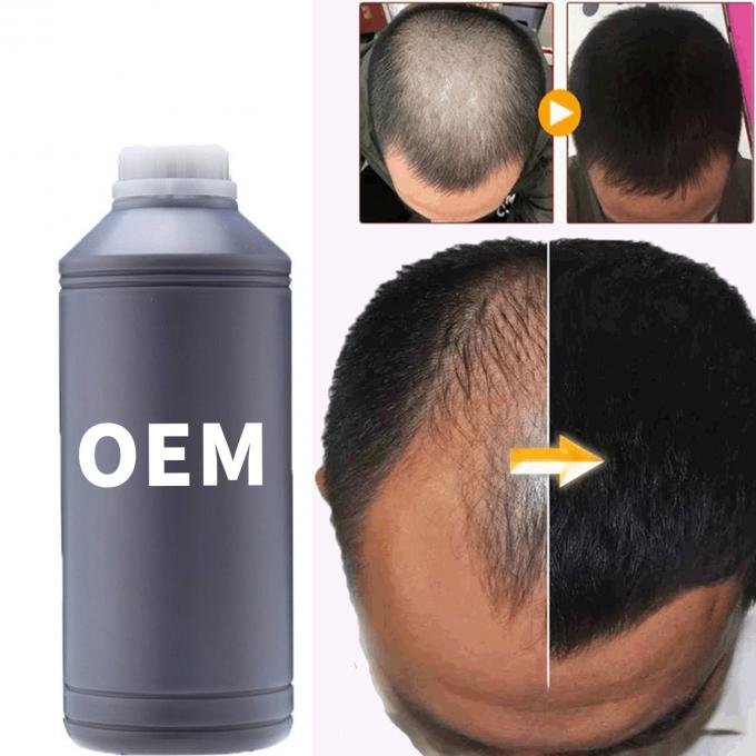 36 meses Vida útil Óleo de soro de crescimento do cabelo para todos os tipos de cabelo 3