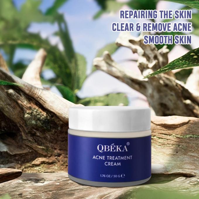 Cremas naturais e orgânicas para o tratamento da acne Quantidade 1000 1