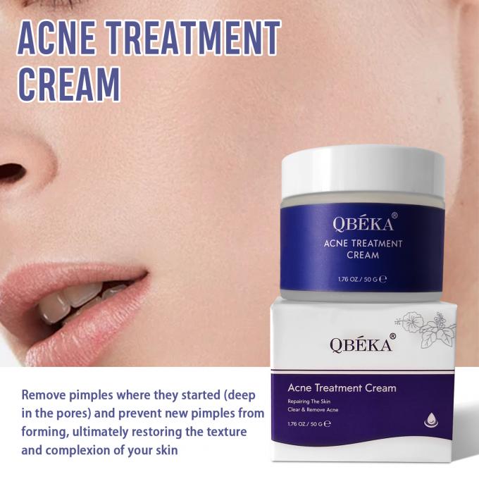 Cremas naturais e orgânicas para o tratamento da acne Quantidade 1000 2