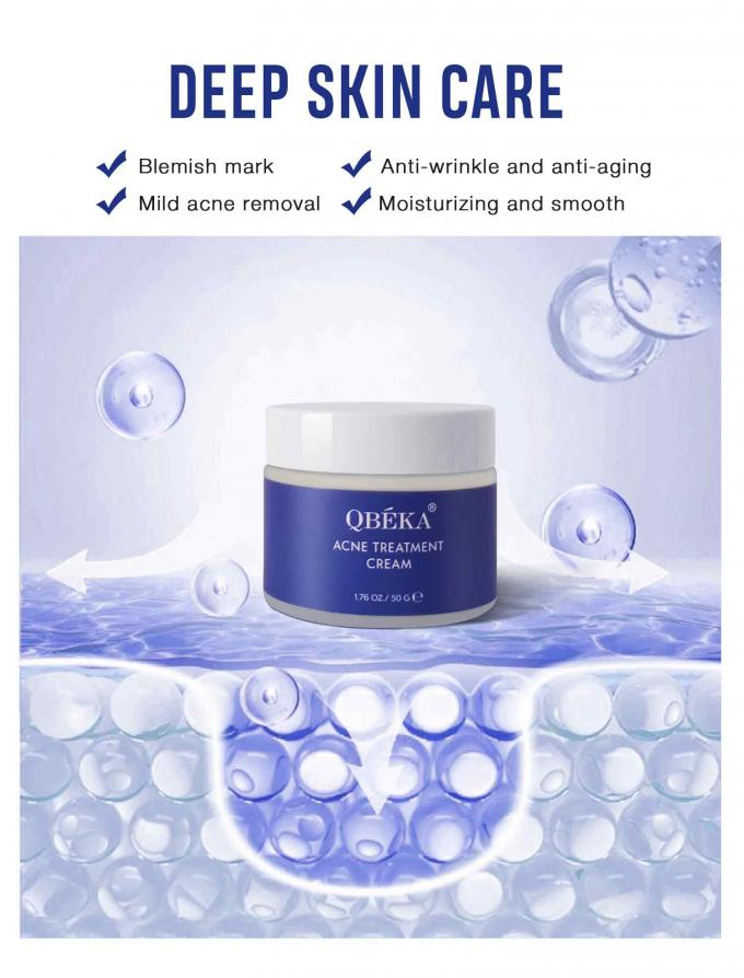 Cremas naturais e orgânicas para o tratamento da acne Quantidade 1000 4