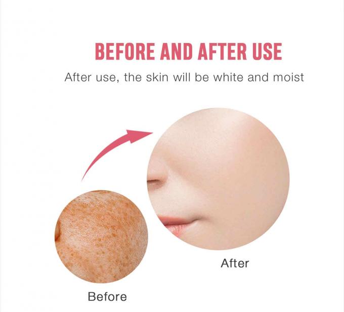 Creme facial de remoção de sardas à base de glicerina para produtos OEM/ODM de cuidados com a pele 8