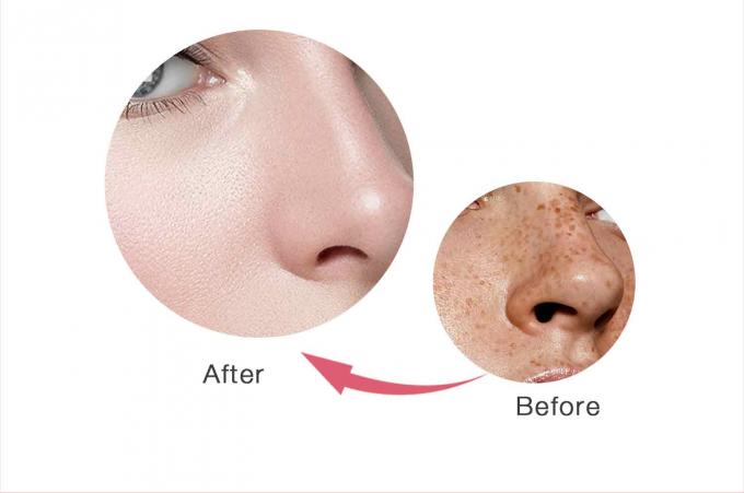 Creme facial de remoção de sardas à base de glicerina para produtos OEM/ODM de cuidados com a pele 9