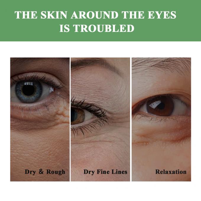 Creme para os olhos anti-rugas para os círculos escuros e inchaço 20 ml de volume Creme para remoção de bolsas nos olhos 8