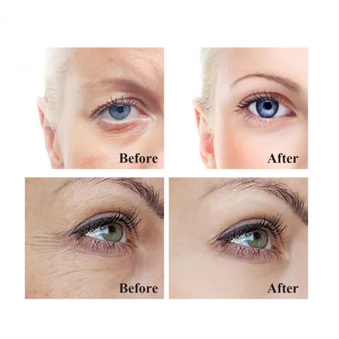 Creme para os olhos anti-rugas para os círculos escuros e inchaço 20 ml de volume Creme para remoção de bolsas nos olhos 9