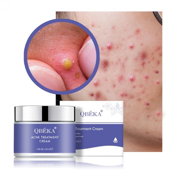 Creme para acne Ponto escuro Conjunto de ervas Vitamina C Desvanece cicatrizes para revitalização da pele feminina 0