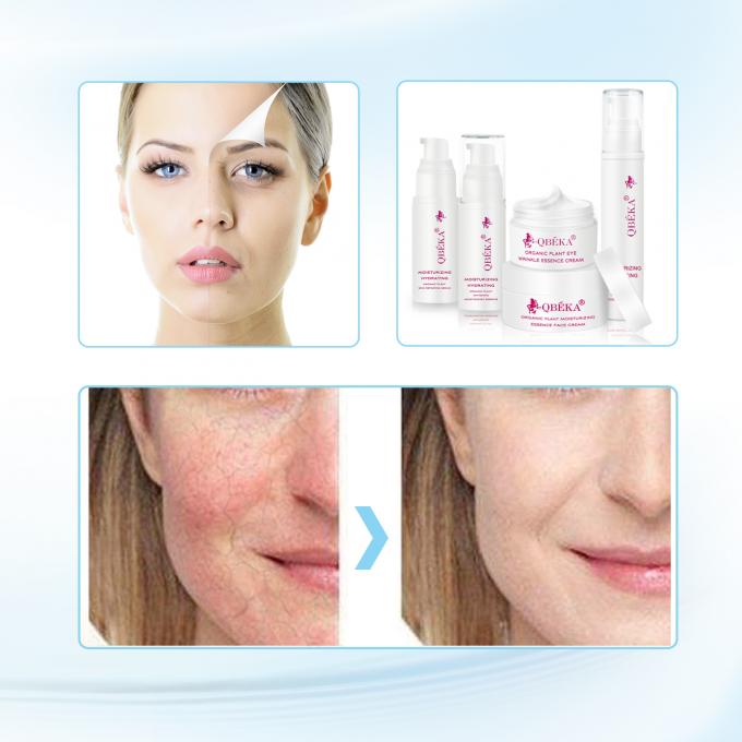 Desbotar Hiperpigmentação Creme Facial Hidratante e Brilhante com Prazo de Vida de 3 anos 2