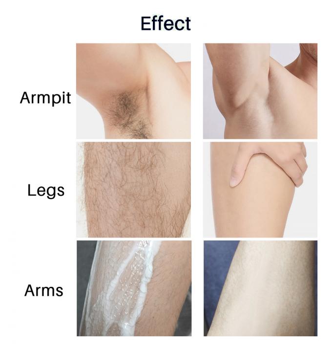 Depilação suave para partes íntimas axilas pernas e braços Nenhuma irritação ou vermelhidão 6