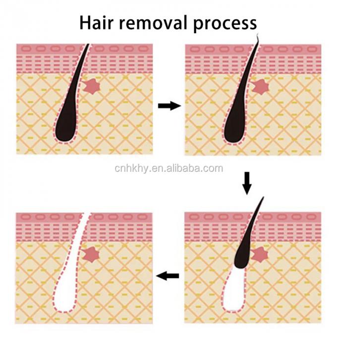 Depilação suave para partes íntimas axilas pernas e braços Nenhuma irritação ou vermelhidão 8