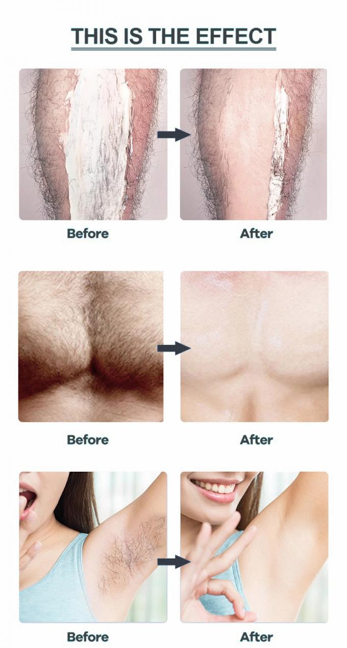 Depilação suave para partes íntimas axilas pernas e braços Nenhuma irritação ou vermelhidão 10