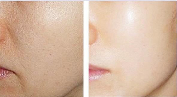 Colágeno Overnight Free Face Sheet 40g Tamanho Jumbo 1000 caixas Alta disponibilidade 4
